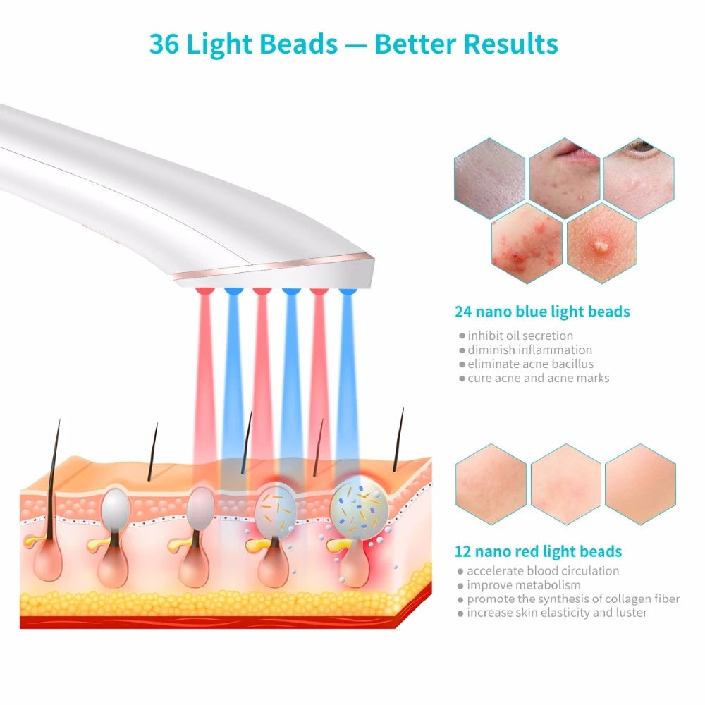 Wireless Rechargeable Acne Light Therapy Device
